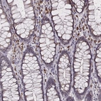 Immunohistochemical staining of human rectum shows moderate membranous-cytoplasmic positivity in lymphoid cells.