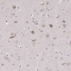 Immunohistochemical staining of human cerebral cortex shows moderate membranous-cytoplasmic positivity in neurons.
