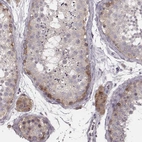 Immunohistochemical staining of human testis shows moderate membranous-cytoplasmic positivity in cells in seminiferous ducts and leydig cells.