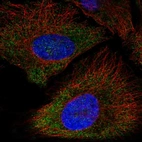 Immunofluorescent staining of human cell line HeLa shows localization to cytosol.