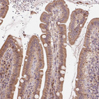 Immunohistochemical staining of human small intestine shows strong cytoplasmic positivity in glandular cells.