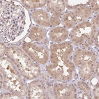Immunohistochemical staining of human kidney shows strong cytoplasmic positivity in cells in tubules.