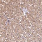 Immunohistochemical staining of human liver shows moderate cytoplasmic positivity in hepatocytes.
