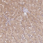 Immunohistochemical staining of human liver shows moderate cytoplasmic positivity in hepatocytes.