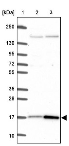 Lane 1: Marker [kDa] 250, 130, 95, 72, 55, 36, 28, 17, 10_br/_Lane 2: Human cell line RT-4_br/_Lane 3: Human cell line U-251 MG