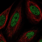 Immunofluorescent staining of human cell line SiHa shows localization to nucleoplasm.