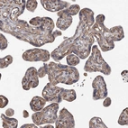 Immunohistochemical staining of human placenta shows moderate cytoplasmic positivity in endothelial cells and weak cytoplasmic positivity in trophoblastic cells.
