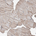Immunohistochemical staining of human skeletal muscle shows weak cytoplasmic positivity in myocytes.