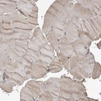 Immunohistochemical staining of human skeletal muscle shows weak cytoplasmic positivity in myocytes.