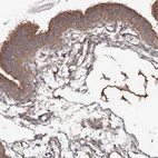 Immunohistochemical staining of human fallopian tube shows moderate cytoplasmic positivity in glandular cells.