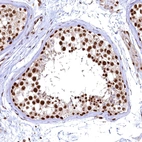 Immunohistochemical staining of human testis shows strong nuclear positivity in cells in seminiferous ducts and leydig cells with weak cytoplasmic positivity.