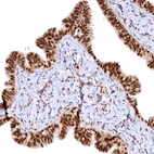 Immunohistochemical staining of human fallopian tube shows strong nuclear positivity in glandular cells with weak cytoplasmic positivity.