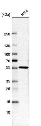 Western blot analysis in human cell line RT-4.