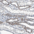 Immunohistochemical staining of human kidney shows moderate cytoplasmic positivity in cells in tubules.