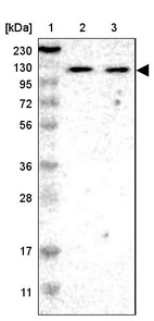 Lane 1: Marker [kDa] 230, 130, 95, 72, 56, 36, 28, 17, 11_br/_Lane 2: Human cell line RT-4_br/_Lane 3: Human cell line U-251MG sp