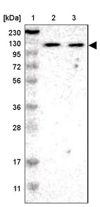 Lane 1: Marker [kDa] 230, 130, 95, 72, 56, 36, 28, 17, 11_br/_Lane 2: Human cell line RT-4_br/_Lane 3: Human cell line U-251MG sp