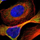 Immunofluorescent staining of human cell line U-2 OS shows localization to cytosol & mitochondria.