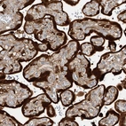 Immunohistochemical staining of human placenta shows strong cytoplasmic positivity in trophoblastic cells.