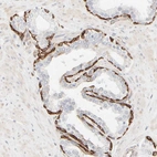 Immunohistochemical staining of human prostate shows strong membranous positivity in glandular cells.