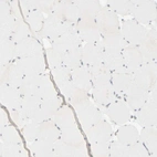 Immunohistochemical staining of human skeletal muscle shows no positivity in myocytes as expected.