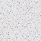 Immunohistochemical staining of human liver shows no positivity in hepatocytes as expected.