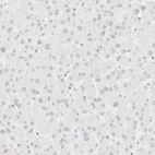 Immunohistochemical staining of human liver shows no positivity in hepatocytes as expected.