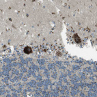 Immunohistochemical staining of human cerebellum shows strong cytoplasmic granular positivity in Purkinje cells.
