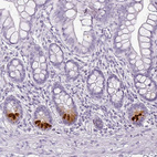 Immunohistochemical staining of human small intestine shows strong cytoplasmic positivity in Paneth cells.