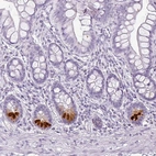 Immunohistochemical staining of human small intestine shows strong cytoplasmic positivity in Paneth cells.