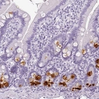 Immunohistochemical staining of human upper duodenum shows strong cytoplasmic positivity in Paneth cells.