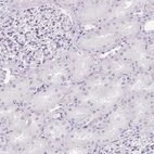 Immunohistochemical staining of human kidney shows no positivity in cells in tubules as expected.