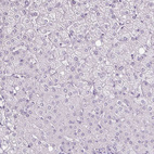 Immunohistochemical staining of human liver shows no positivity in hepatocytes as expected.