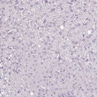 Immunohistochemical staining of human liver shows no positivity in hepatocytes as expected.