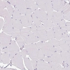 Immunohistochemical staining of human skeletal muscle shows no positivity in myocytes as expected.