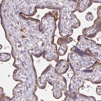 Immunohistochemical staining of human placenta shows strong cytoplasmic granular positivity in trophoblastic cells.