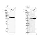 Western blot analysis using Anti-DLAT antibody HPA040786 (A) shows similar pattern to independent antibody HPA062766 (B).