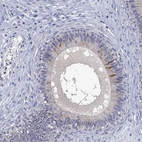 Immunohistochemical staining of human epididymis shows strong cytoplasmic positivity in a subset of glandular cells.