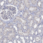 Immunohistochemical staining of human kidney shows weak cytoplasmic positivity in cells in tubules.