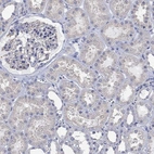 Immunohistochemical staining of human kidney shows weak cytoplasmic positivity in cells in tubules.