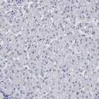 Immunohistochemical staining of human liver shows no positivity in hepatocytes as expected.