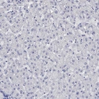 Immunohistochemical staining of human liver shows no positivity in hepatocytes as expected.