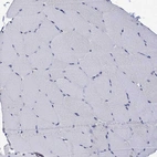 Immunohistochemical staining of human skeletal muscle shows no positivity in myocytes as expected.