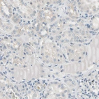 Immunohistochemical staining of human kidney shows cytoplasmic positivity in cells in tubules.