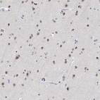Immunohistochemical staining of human cerebral cortex shows moderate nuclear positivity in neurons.