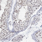 Immunohistochemical staining of human testis shows moderate nuclear positivity in cells in seminiferous ducts.