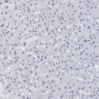 Immunohistochemical staining of human liver shows no positivity in hepatocytes as expected.