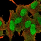 Immunofluorescent staining of human cell line SH-SY5Y shows localization to nucleus, nucleoli & plasma membrane.