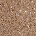 Immunohistochemical staining of human cerebral cortex shows strong cytoplasmic-membranous positivity in neuropil.