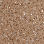 Immunohistochemical staining of human cerebral cortex shows strong cytoplasmic-membranous positivity in neuropil.