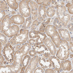 Immunohistochemical staining of human kidney shows moderate cytoplasmic-membranous positivity in cells in tubules.
